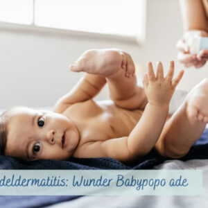 Wunder Babypopo: Hilfe bei Windeldermatitis